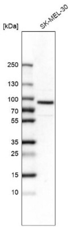 LIM kinase 2 Antibody, Novus Biologicals:Antibodies:Primary Antibodies