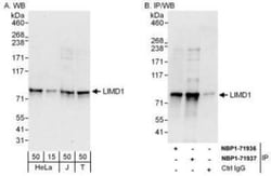 LIMD1 Antibody, Novus Biologicals 0.1mL; Unlabeled:Antibodies, Polyclonal