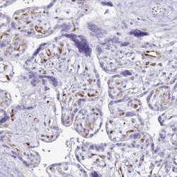 LIN-28B Antibody, Novus Biologicals 0.1mL; Unlabeled:Antibodies, Polyclonal