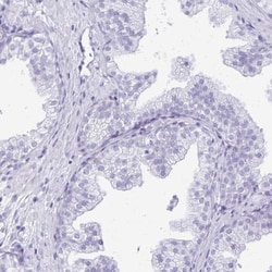 LIN-28B Antibody, Novus Biologicals 0.1mL; Unlabeled:Antibodies, Polyclonal