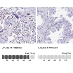 LIN-28B Antibody, Novus Biologicals 0.1mL; Unlabeled:Antibodies, Polyclonal