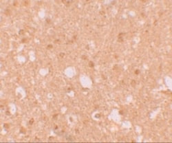 LIN-41/TRIM71 Antibody - BSA Free, Novus Biologicals 0.1mg; Unlabeled:Antibodies,
