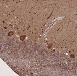LIN37 Antibody, Novus Biologicals 0.1mL; Unlabeled:Antibodies, Polyclonal