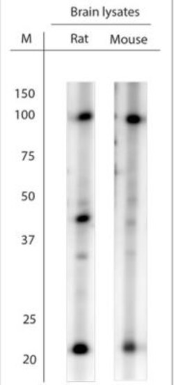 LINGO-1 Antibody, Novus Biologicals 0.1 mL; Unconjugated:Anticuerpos
