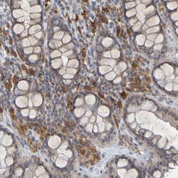 LIR-8/CD85c/LILRB5 Antibody, Novus Biologicals 0.1mL; Unlabeled:Antibodies,