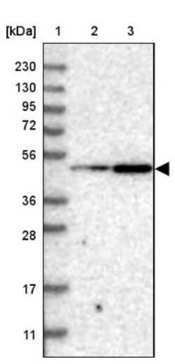 LIS1 Antibody, Novus Biologicals 0.1mL; Unlabeled:Antibodies, Polyclonal