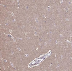 LIX1 Antibody, Novus Biologicals 25 &mu;L | Buy Online | Novus Biologicals | Fisher Scientific