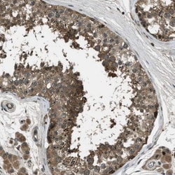 LKB1/STK11 Antibody, Novus Biologicals 25 &mu;L; Unlabeled:Antibodies,