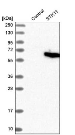 LKB1/STK11 Antibody, Novus Biologicals 25 &mu;L; Unlabeled:Antibodies,