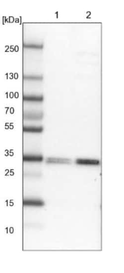 LMAN2L Antibody, Novus Biologicals 0.1mL; Unlabeled:Antibodies, Polyclonal