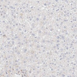 LMCD1 Antibody, Novus Biologicals 25 &mu;L; Unlabeled:Antibodies, Polyclonal