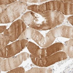 LMCD1 Antibody, Novus Biologicals 25 &mu;L; Unlabeled:Antibodies, Polyclonal
