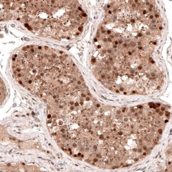 LMO7 Antibody, Novus Biologicals 0.1mL; Unlabeled:Antibodies, Polyclonal