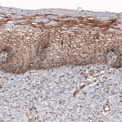 LMO7 Antibody, Novus Biologicals 0.1mL; Unlabeled:Antibodies, Polyclonal