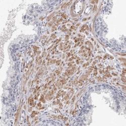 LMOD1 Antibody, Novus Biologicals:Antibodies:Primary Antibodies
