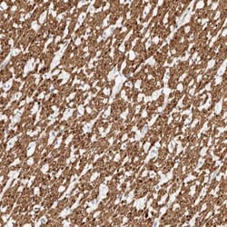 LMOD1 Antibody, Novus Biologicals 25 &mu;L; Unlabeled:Antibodies, Polyclonal