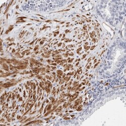 LMOD1 Antibody, Novus Biologicals 25 &mu;L; Unlabeled:Antibodies, Polyclonal