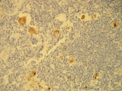 LMP1 Antibody (S20-D), Novus Biologicals 100&mu;L; Unlabeled:Antibodies,