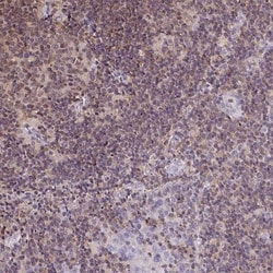 LMP2/PSMB9 Antibody, Novus Biologicals 0.1mL; Unlabeled:Antibodies, Polyclonal