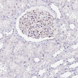 LMP2/PSMB9 Antibody, Novus Biologicals 0.1mL; Unlabeled:Antibodies, Polyclonal