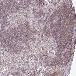 LMP2/PSMB9 Antibody, Novus Biologicals 0.1mL; Unlabeled:Antibodies, Polyclonal