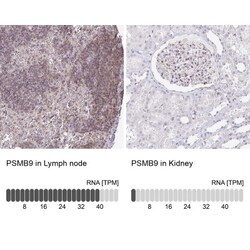 LMP2/PSMB9 Antibody, Novus Biologicals 0.1mL; Unlabeled:Antibodies, Polyclonal