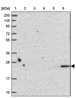 LMP2/PSMB9 Antibody, Novus Biologicals 0.1mL; Unlabeled:Antibodies, Polyclonal