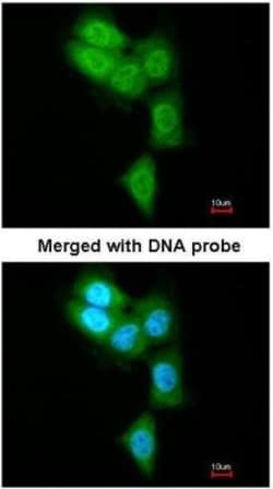 LMP7/PSMB8 Antibody, Novus Biologicals 0.1mL; Unlabeled:Antibodies