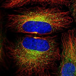LMP7/PSMB8 Antibody, Novus Biologicals 0.1mL; Unlabeled:Antibodies, Polyclonal
