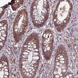 LMP7/PSMB8 Antibody, Novus Biologicals 0.1mL; Unlabeled:Antibodies, Polyclonal
