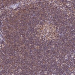 LMP7/PSMB8 Antibody, Novus Biologicals 0.1mL; Unlabeled:Antibodies, Polyclonal