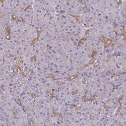 LMP7/PSMB8 Antibody, Novus Biologicals 0.1mL; Unlabeled:Antibodies, Polyclonal