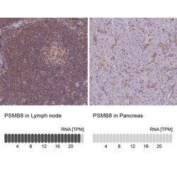 LMP7/PSMB8 Antibody, Novus Biologicals 0.1mL; Unlabeled:Antibodies, Polyclonal