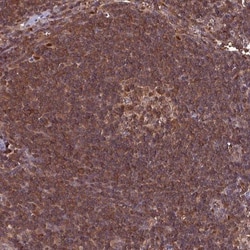 LMP7/PSMB8 Antibody, Novus Biologicals 0.1mL; Unlabeled:Antibodies, Polyclonal