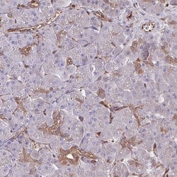 LMP7/PSMB8 Antibody, Novus Biologicals 0.1mL; Unlabeled:Antibodies, Polyclonal