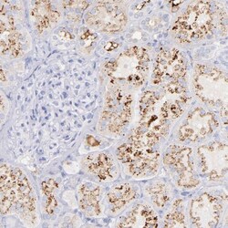Kininogen Antibody, Novus Biologicals 25 &mu;L; Unlabeled:Antibodies, Polyclonal