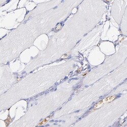 Kininogen Antibody, Novus Biologicals 25 &mu;L; Unlabeled:Antibodies, Polyclonal