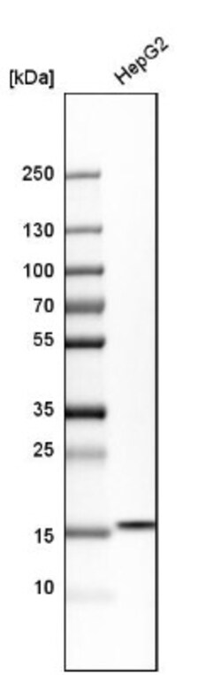LMW-PTP/ACP1 Antibody, Novus Biologicals:Antibodies:Primary Antibodies