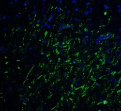 LMX1A Antibody - BSA Free, Novus Biologicals 0.025 mg, Unlabeled:Antibodies,