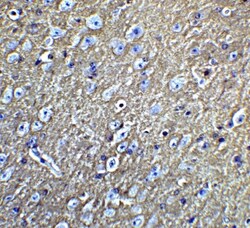 LMX1b Antibody - BSA Free, Novus Biologicals 0.025 mg, Unlabeled:Antibodies,