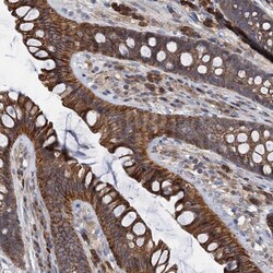 LNX2 Antibody, Novus Biologicals:Antibodies:Primary Antibodies
