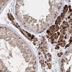 MGAT4D Antibody, Novus Biologicals:Antibodies:Primary Antibodies
