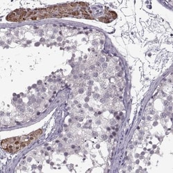 MGAT4D Antibody, Novus Biologicals:Antibodies:Primary Antibodies