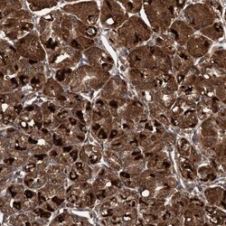 LOH12CR1 Antibody, Novus Biologicals 25 &mu;L, Unlabeled:Antibodies, Polyclonal