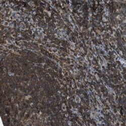 LOK Antibody, Novus Biologicals 0.1mL; Unlabeled:Antibodies, Polyclonal