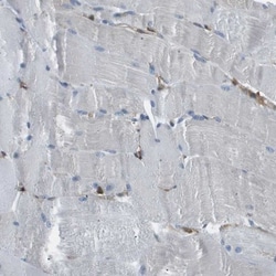 LOK Antibody, Novus Biologicals 0.1mL; Unlabeled:Antibodies, Polyclonal