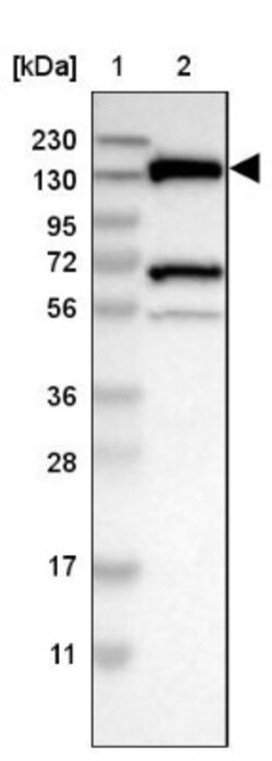 LOK Antibody, Novus Biologicals 0.1mL; Unlabeled:Antibodies, Polyclonal