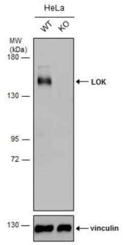 LOK Antibody, Novus Biologicals 0.1mL; Unlabeled:Antibodies, Polyclonal