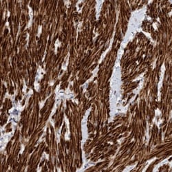 LONRF1 Antibody, Novus Biologicals 25 &mu;L | Buy Online | Novus Biologicals | Fisher Scientific