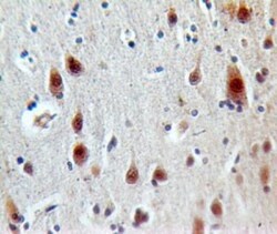 LOX-1/OLR1 Antibody, Novus Biologicals 0.1mg; Unlabeled:Antibodies, Polyclonal